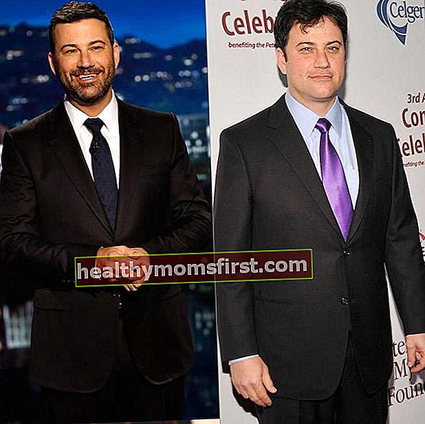 Jimmy Kimmel sebelum dan sesudah