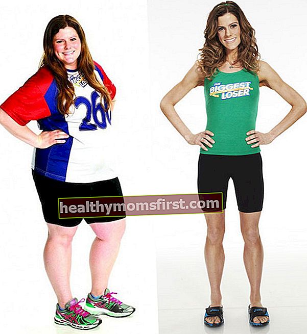 Rachel Frederickson sebelum dan sesudah penurunan berat badan
