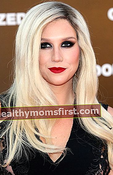 Kesha 2013 lipstik merah lucu